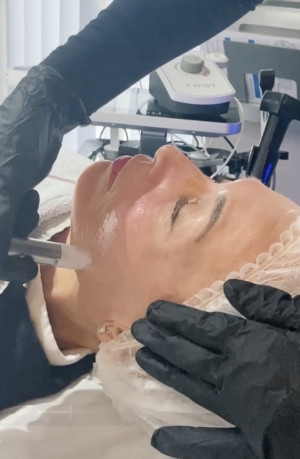 xcellaris twist microneedling