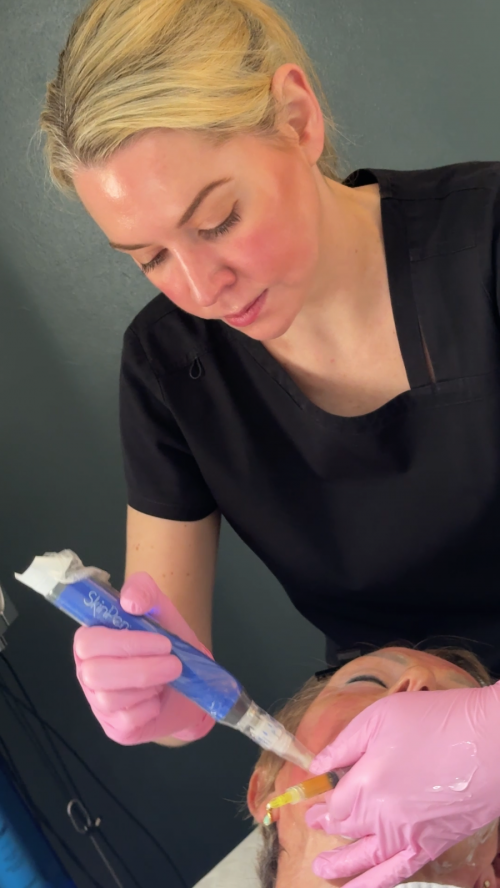 iprf microneedling