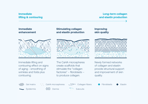 graphic to show how radiesse works