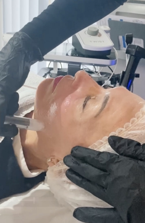 xcellaris twist microneedling