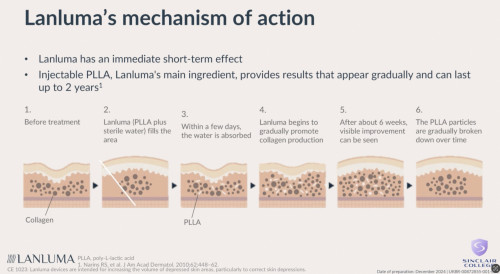 Lanluma mechanism of action image