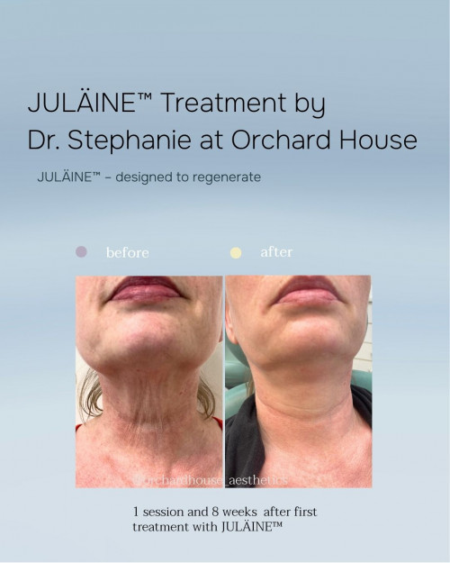 Julaine before and after northallerton