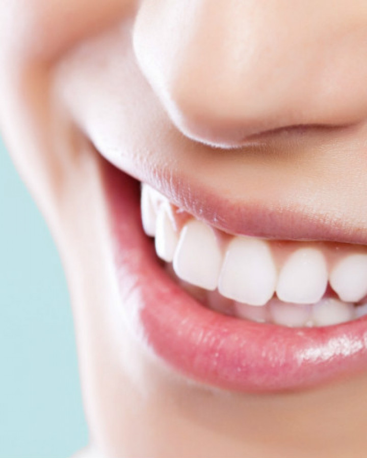 close up of a woman's smile to show dental care at orchard house northallerton