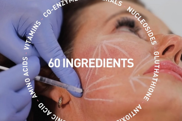 injection planning for NCTF