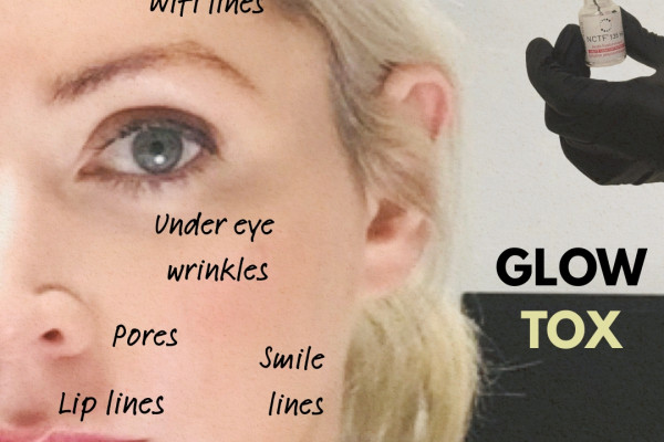 GLOWTOX2